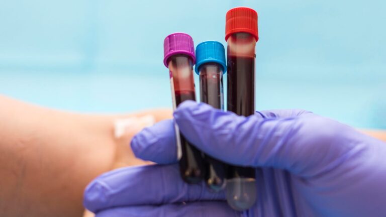 Make sure you stay on top of these 6 blood tests when monitoring your health